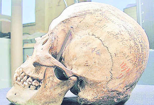 El cráneo de Liempichun Sacamata
